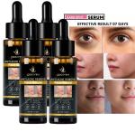 ODDEVEN Dark spot remover serum For women & men - removal serum  (30 ml) (Pack of 4)