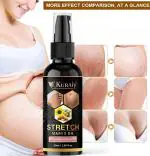 Kuraiy 100% Natural stretch Oil for Stretch Marks Removal Post Pregnancy fast work 100% result stretch mark cream oil (50 ml)