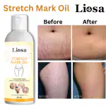 LIOSA, stretch mark oil, Premium Repair Stretch Marks Removal oil, Natural Heal Hip, Legs, Mark oil, Stretch Marks And Scars Oils, pack of 1 (50 ml)