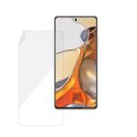 Gadgets Protector Transparent Thermoplastic Polyurethane Xiaomi 11T Pro Screen Protector with Installation Kit (17.2 x 11.6 x 1.3 cm)