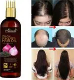 Phillauri Onion Hair Oil With Black Seed Oil Extracts - Controls Hair Fall 100ml