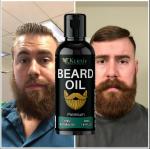 KURAIY Beard Growth Essential Oil 100% Natural Beard Growth Oil Hair Loss Products For Men Beard Care Hair Growth Nourishing Beard Care