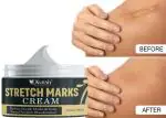 KURAIY 100% Pure Maternity Stretch Marks Removal Cream Body Buttock Breast Mark Skin Care Effective Anti White Stretch Scar Remover Cream 50g