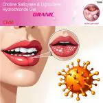 Oranil Mouth Ulcer Gel Treatment (Pack Of 5)