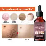 Groovy Natural Stretch Oil, 14 Herbal Oils-Kachur, Jiwanti, Peepal and Nariyala 40ml ml)