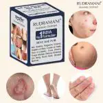 Rudramani Ayurvedic Anti Khujali Malam -Ringworm, itching, Eczema, Skin Infection, Skin Tretment 25G