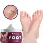 KURAIY foot corn remover Cream , for dry hard cracked heel skin repair / swelling & pain relief / feet care men and women.