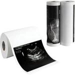 REVALS Ultrasound Thermal Printer Paper Rolls 110S 110mm*20 meter (Set of 5 Roll)