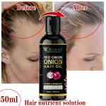KURAIY ONION OIL Anti Hair Fall Treatment Hair Growth Essence Oil Scalp Massage Moisturizing Thick Hair Nutrition Spray 50 ML