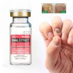 AdiExpress Nail Cuticle Oil Nourishment, Finger Prevent Agnails Treatment, Healthy Nail Growth