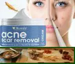 KURAIY Natural Scar Removal Cream Gel Remove Acne Spots Treatment Stretch Marks Burn Surgical Scar Repair Cream Smoothing Skin Beauty