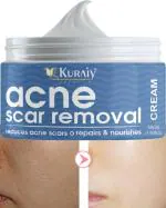 KURAIY 100% Acne Removal Face Cream Herbal Anti Acne Gel Pore Shrink Fade Face Back Acne Mark Scar Tea Tree Serum Acne Treatment Skin Care