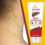 Metaverse Men & Women Wart Removal Cream Wart Remover Ointment for Facial Skin Care
