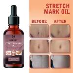 Groovy Anti-Stretch Marks Skin Oil With Vitamin E & Rosehip Oil (100 ml) 40 ml)