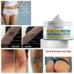 KURAIY Body Whitening Cream Underarm Knee Buttocks Private Bleach Remove Melanin Pigmentation Improve Dull Brighten Skin Care