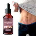 Groovy Stretch Marks Scar removal oil in during after pregnancy delivery women,organic Bio Oil,anti Cellulite,remover scars 40ml