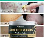 KURAIY Pure Arrival Effective stretch marks scar removal Cream slack line firming & lifting skin stretch mark repair cream