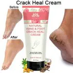Intimify Hand & Foot Crack Heal Cream for Crack of Foot, Heals, Hands & Moisturizes the Skin