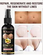 Kuraiy 100% Natural Actives Stretch Marks Removal Cream Oil for Women in During After Pregnancy No Paraben No Sulphate No Added Colors or Fragrance No Mineral Oil Cellulite Remover Massage Slimming Oil Remove