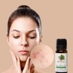 REVITAL Tea Tree Oil 10ml 100% Pure & Natural Essential Oil for Skin, Hair, Face, Acne Care Powerful Antifungal & Antimicrobial Properties Soothes Irritation, NonToxic, CrueltyFree(Pack of 2)