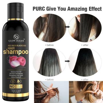 GlowOcean Onion Shampoo with Onion and Plant Keratin for Hair Fall Control