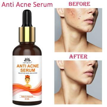 Intimify Acne Serum for Acne & Pimple Spots, Softens & Tightens Skin, Dark Spots & Pigmentation
