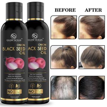 GlowOcean Onion Blackseed Hair Oil - For Hair Fall Control,Hair Growth & Control Dandruff