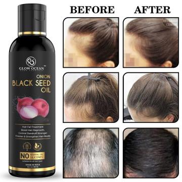 Ocean Onion Blackseed Hair oil For Hair Fall Control &Hair Growth Oil