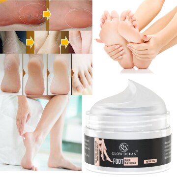 sPersonal CareSkin CareFace Cream & Moisturizer GlowOcean Crack Cream- For Crack Blaster Repair | Cracked Skin | Crack Blaster Dry Skin | foot cream