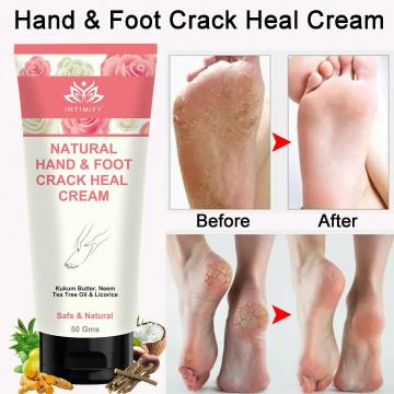 Intimify Hand & Foot Crack Heal Cream for Cracked Heel Repair, Foot Crack Cream