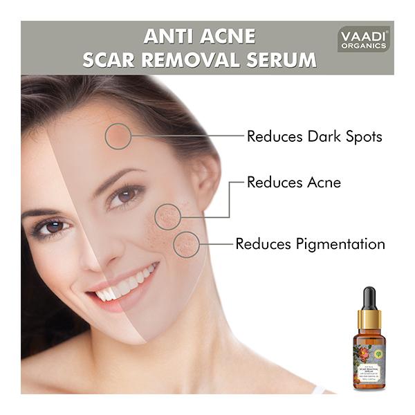 Vaadi Herbals 100 Pure Essential Oil Anti Acne Scar Removal Serum