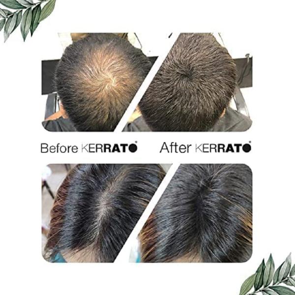 Kerrato Hair Fibres for Thinning Hair (LIGHT BROWN) Natural - 4g - Conceals Hair  Loss in 10 seconds - Natural Hair Thickener & Fibers for Thin Hair for Men  & Women - JioMart