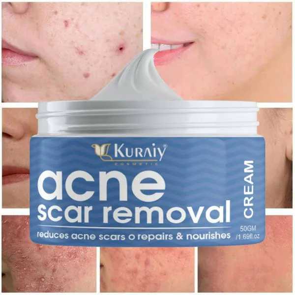 KURAIY ACNE SCAR CREAM 50GM JioMart