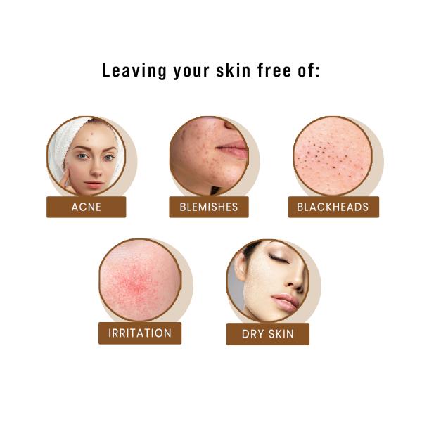 Sirona Exfoliating Face Wash for Blemish, Acne & Dead Skin Removal