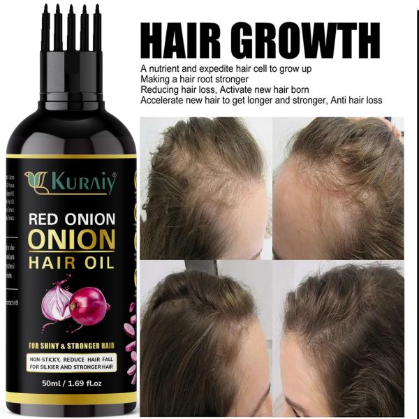 KURAIY Red Onion Hair Oil 7 Day Challenge for Hair growth (50 ml ) & (MEN &  WOMEN) - JioMart