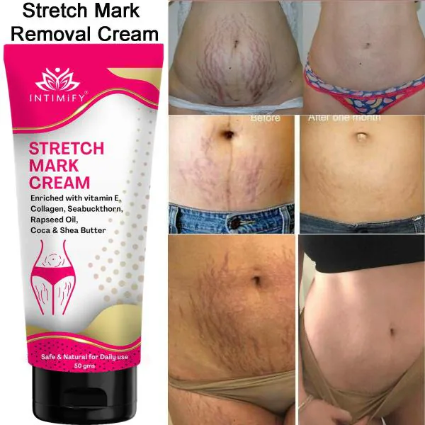 Intimify Stretch Mark Cream for Stretch Mark Removal, pregnency stretch