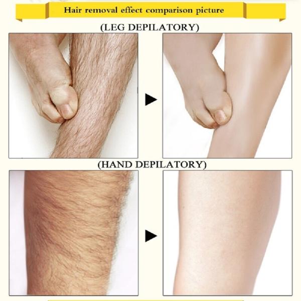 KURAIY New Permanent Hair Removal Cream Painless Hair Remover For Armpit  Legs and Arms Skin Care Body Care Depilatory Cream For Men Women - JioMart