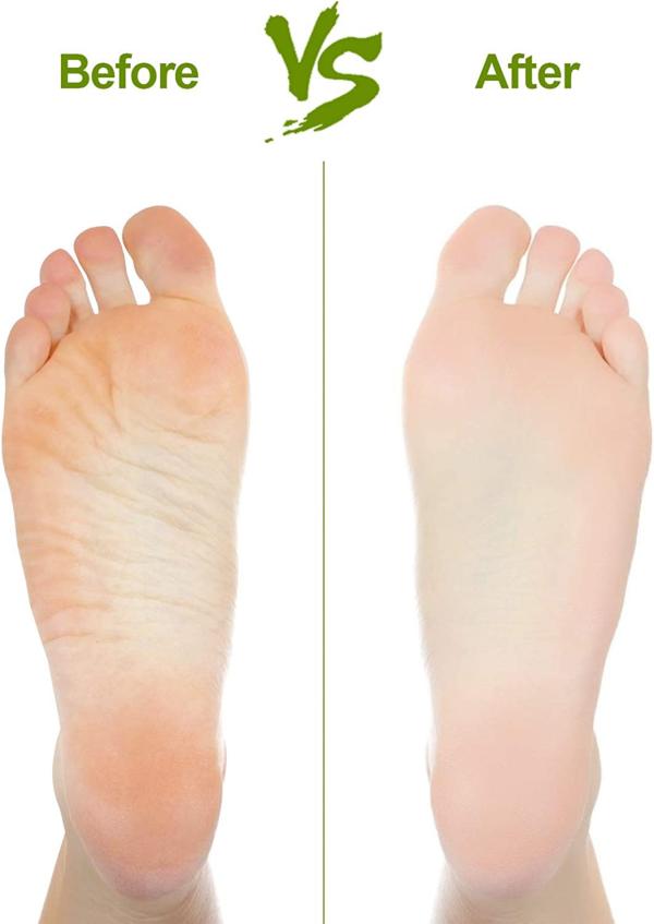 Cuccio Callus Removal Pumice Natural Lava Stone, Heel & Elbow Treatment