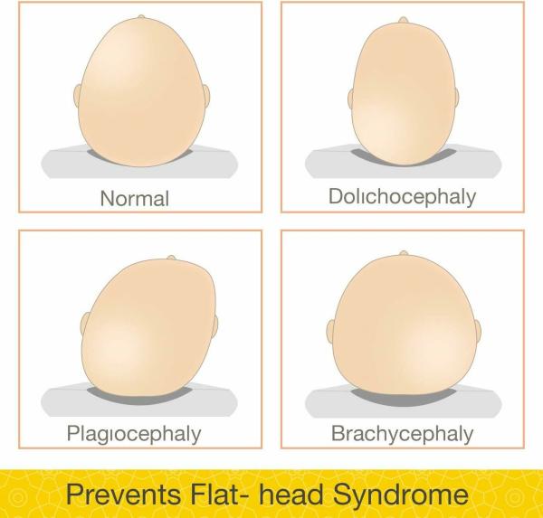 MOM CARES Yellow Mustard Seed Newborn Baby Pillow Ideal For Round Head