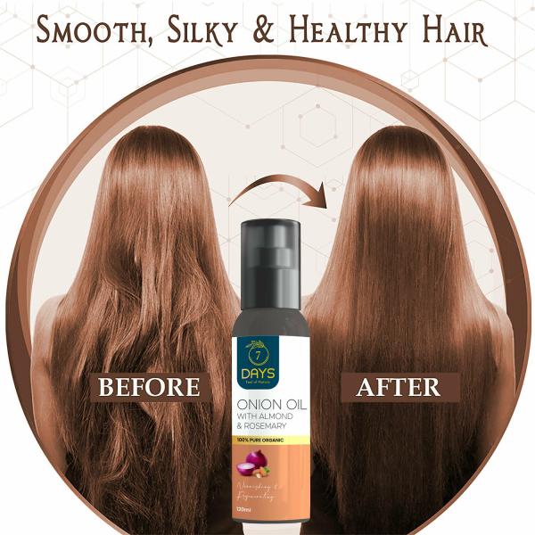 7 Days Onion Blackseed oil for hair Regrowth Control Hair fall Dandruff  100% Result Hair Oil (120 ml) - JioMart