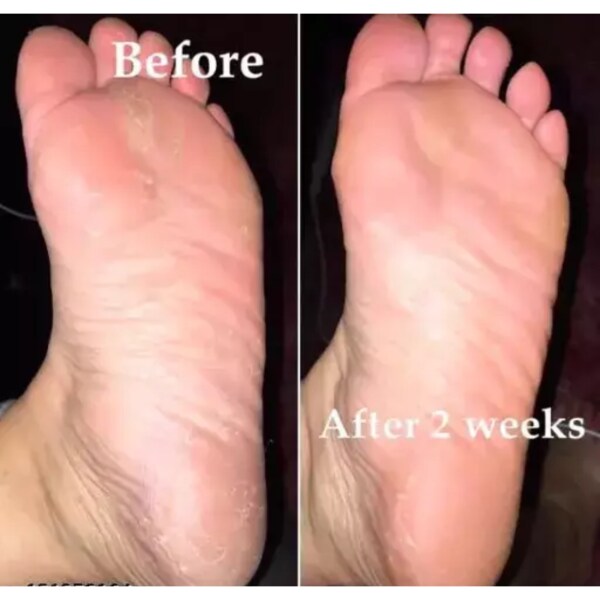 Crack Blaster cream Smooth Foot Crack Cracked Heel Repair Foot Cream (100 g) JioMart