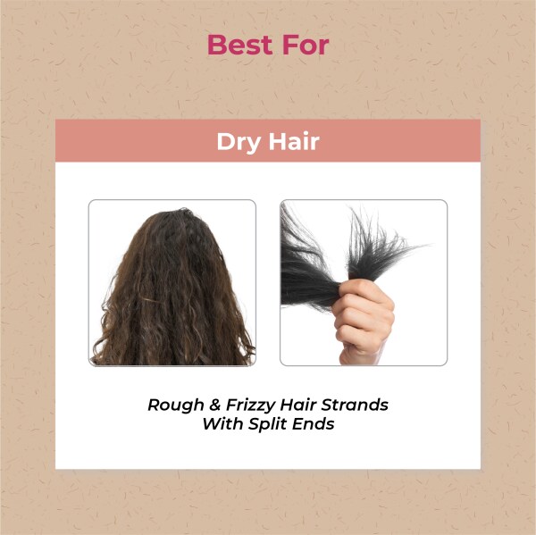 Vedix Ayurvedic Onion Strength Shampoo For Dry Hair - Trati Hydronourish  Dandruff Shampoo -250ml - JioMart