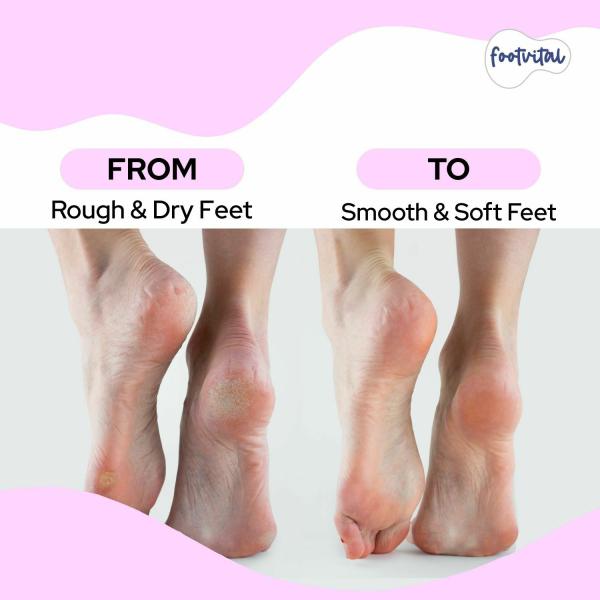 Footvital Combo of Foot Scrub & Pedicure Tool for Rough & Dry Feet