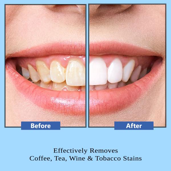 Oralvit Sodium Bicarbonate Teeth Whitening Powder with Baking Soda