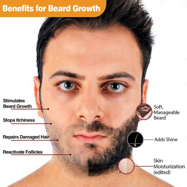SURBHI Hair Growth Set - Beard Oil & Hair Growth Oil - For Long, Perfect & Shiny  Hairs - 170ml - JioMart
