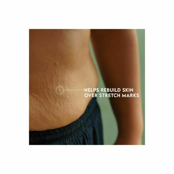 Kinsfolk Almond, Rose Stretch Oil Reduce Stretch Marks And Relieves