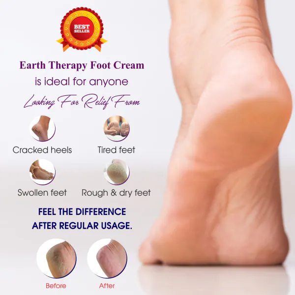 EARTH THERAPY Foot Cream For Cracked Heels, Dry Skin, Feet Repair, Knee