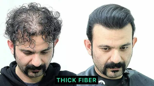 THICK FIBER Hair Building Fibers (BLACK) 12gm, Hair Fiber for Thinning Hair  & Bald spots - JioMart