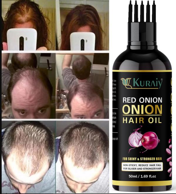 KURAIY Red Onion Oil Hair Growth Products Fast Growing Hair Oil Loss
