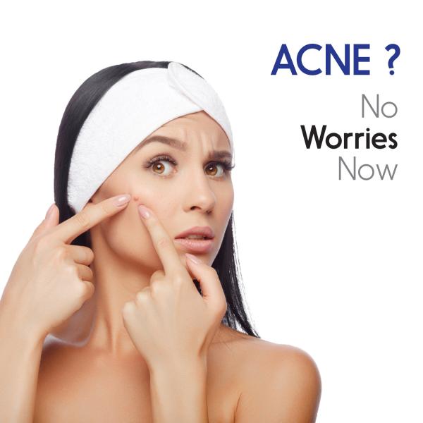 Fabskin Calendula Soap For Acne 75gm Pack of 8 Face, Back & Body Acne Wash JioMart